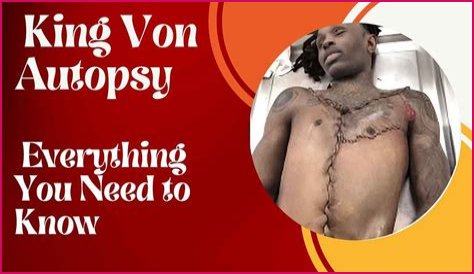 King Von Autopsy Report: Graphic Photos And Details
